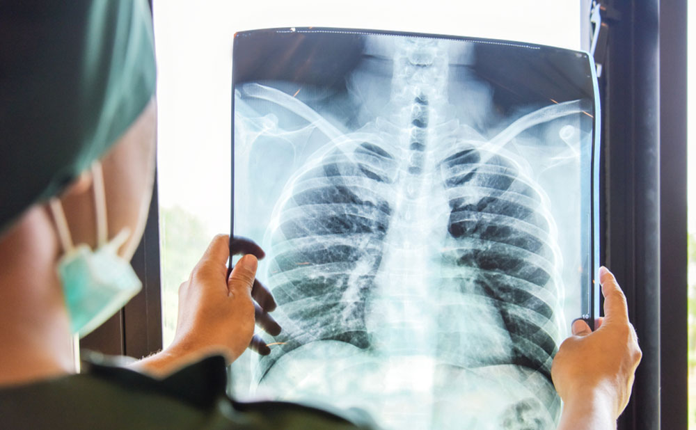 Chest-X-Rays---Royalty-Occupational-Health