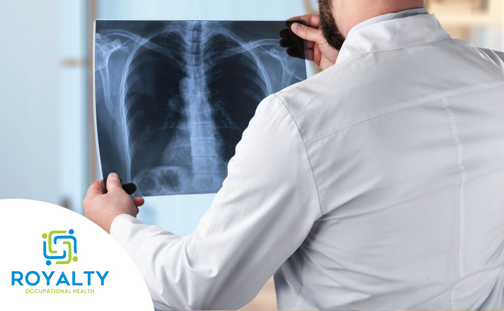 Chest-X-Rays---Royalty-Occupational-Health